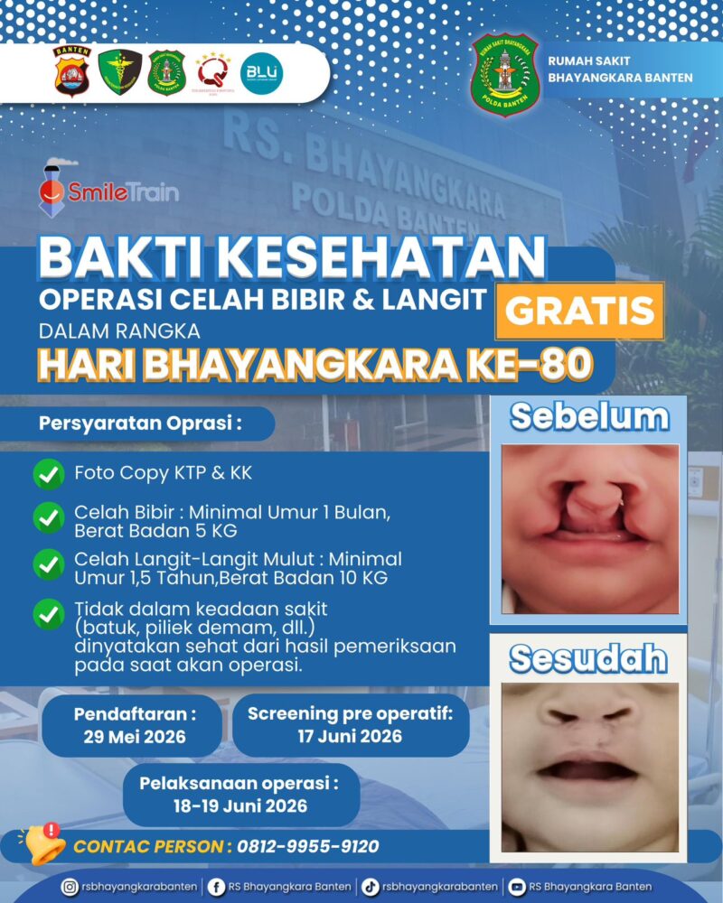Semarak Hari Bhayangkara ke-80, Polda Banten Gelar Donor Darah dan Khitanan Gratis
